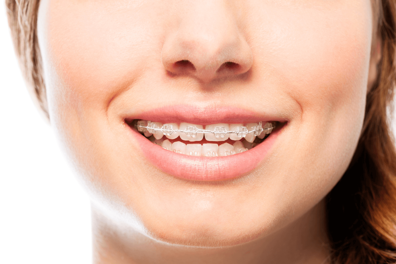 Ortodonţie