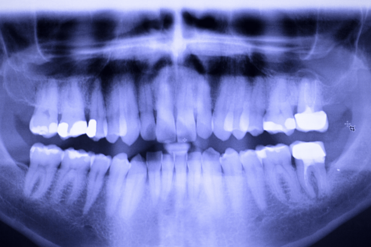 Radiologie dentară